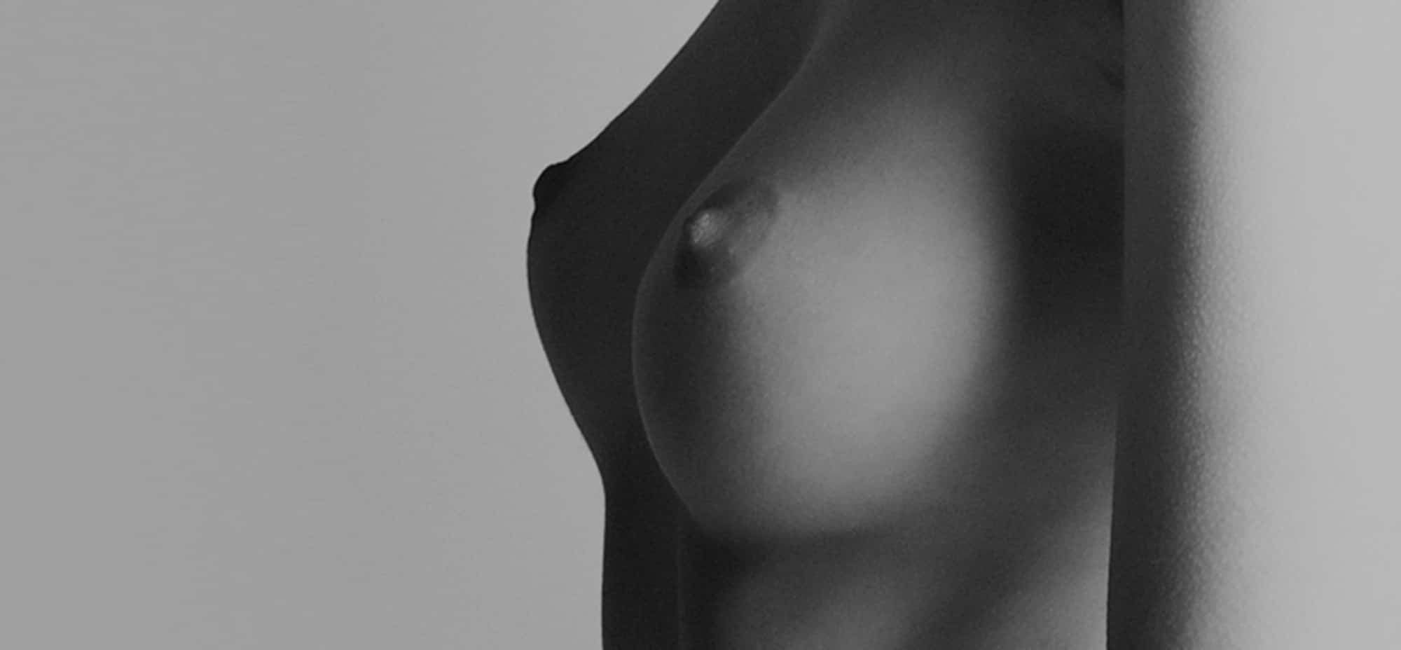 Le lifting des seins, une solution pour beaucoup de femmes | Nice | Docteur Cornil