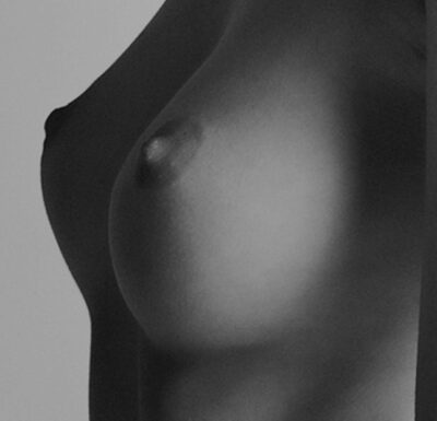 Le lifting des seins, une solution pour beaucoup de femmes | Nice | Docteur Cornil